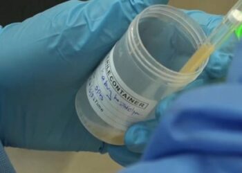 Virus de Marburg en Guinée équatoriale: 20 morts, selon un nouveau bilan de l’OMS