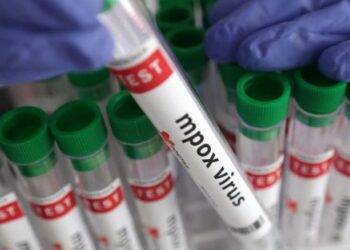 Mpox au Sénégal : la vérité sur les cas contacts