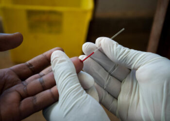 Lutte contre le VIH : « Les patients ont disparu »